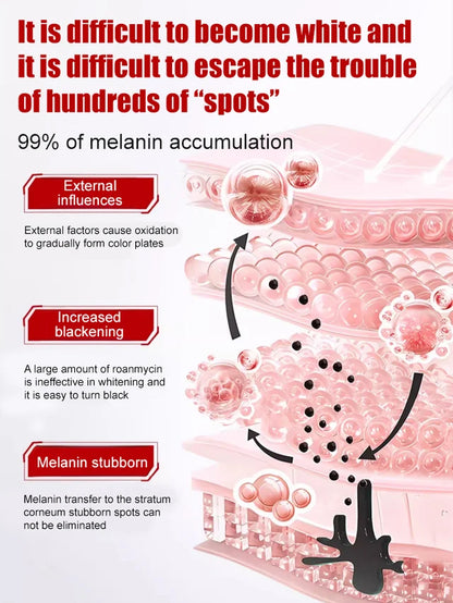 Dark Spot Corrector 🔥Hot Sales Now 50% OFF🔥🎉