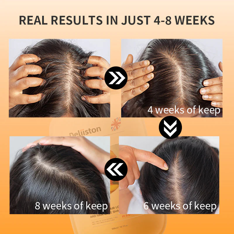 Deliiston Anti-Hair Loss Shampoo