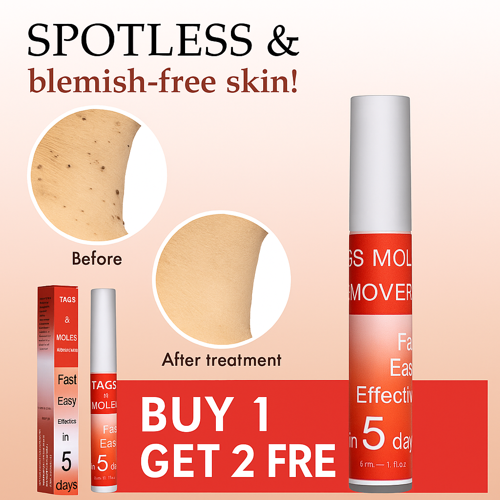 LOVILDS™ Tags & Moles Remover