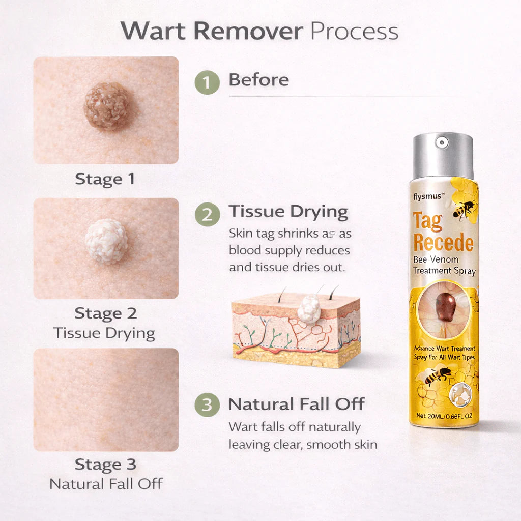 Wart Remover Spray – Fast & Easy At-Home |Bee Venom Skin Tag Remover Spray