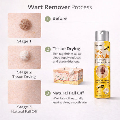 Wart Remover Spray – Fast & Easy At-Home |Bee Venom Skin Tag Remover Spray