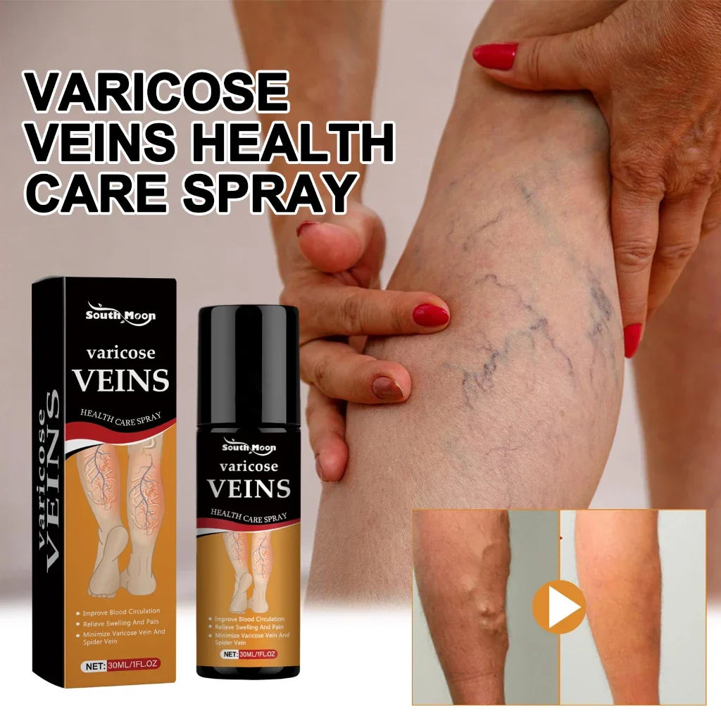 Turmeric Varicose Vein Relief