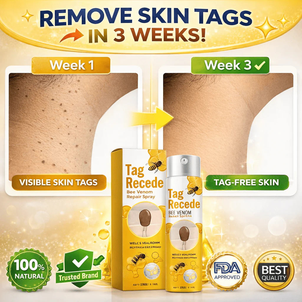Wart Remover Spray – Fast & Easy At-Home |Bee Venom Skin Tag Remover Spray
